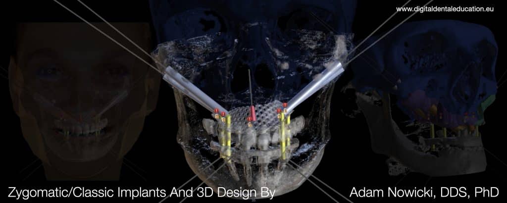 ‎Michalska FULL.‎035