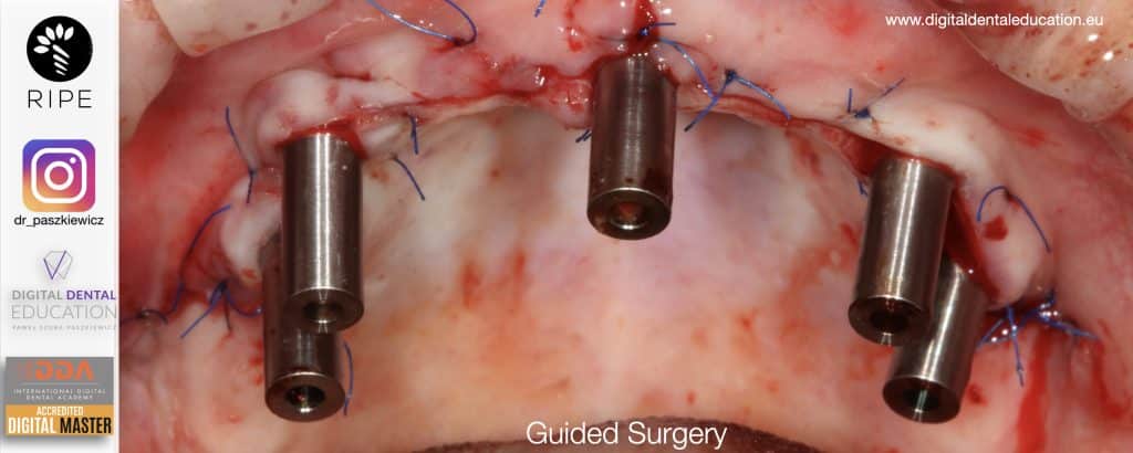 ‎Michalska FULL.‎040