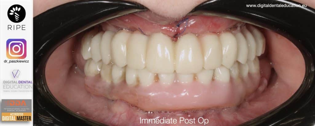 ‎Michalska FULL.‎044