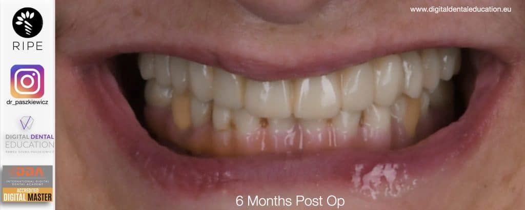 ‎Michalska FULL.‎045