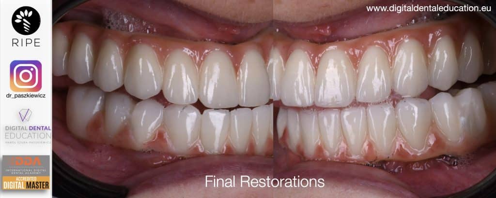 ‎Michalska FULL.‎086