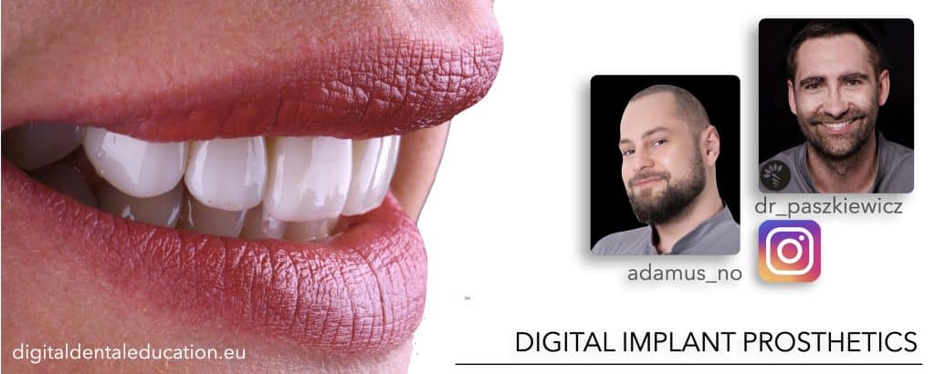 ‎Michalska FULL.‎094