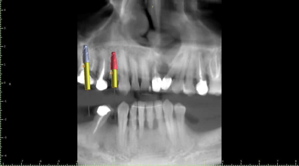 Fayssal Naciri1-Panoramic View