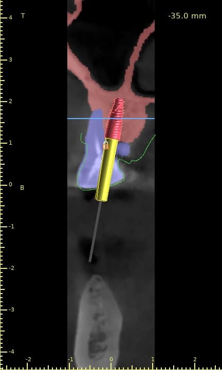 Fayssal Naciri2-Cross Sections