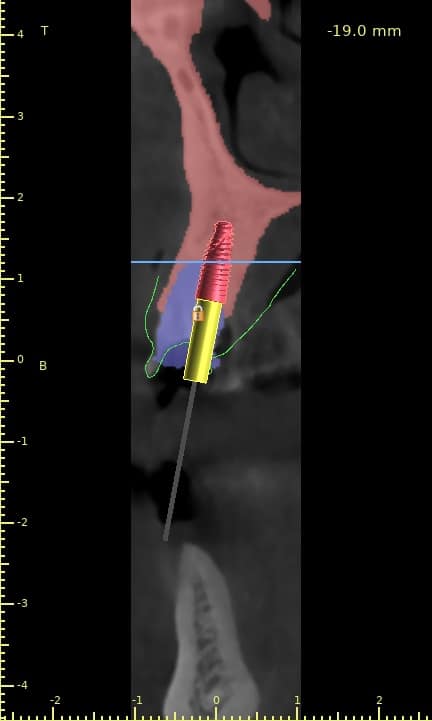 Fayssal Naciri4-Cross Sections