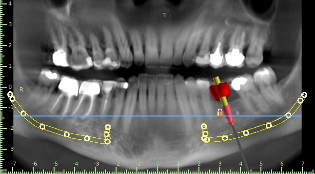 Rafifi zohra-Fatima0-Panoramic View