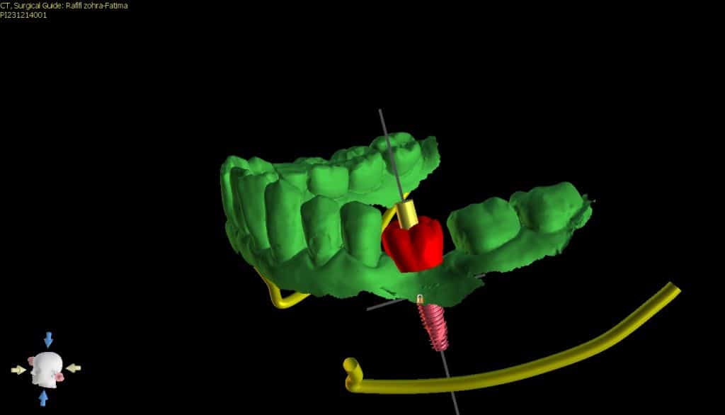 Rafifi zohra-Fatima3-3D View