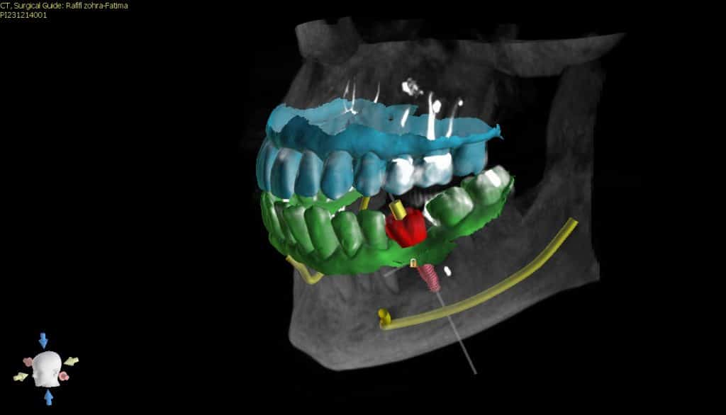 Rafifi zohra-Fatima4-3D View