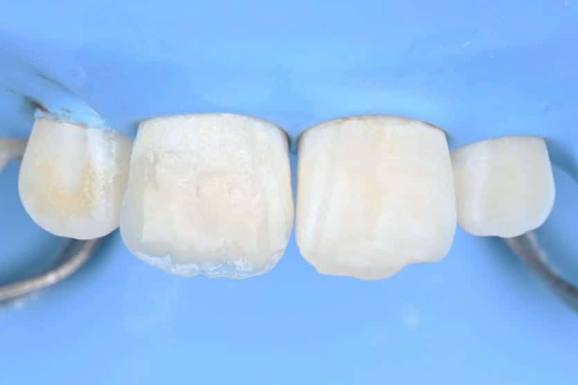 21755E17-BE36-495A-BA4C-328BB0520E66