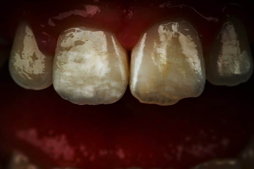 2BF48F9C-813D-47D9-8D1F-4DFA3AC8303F