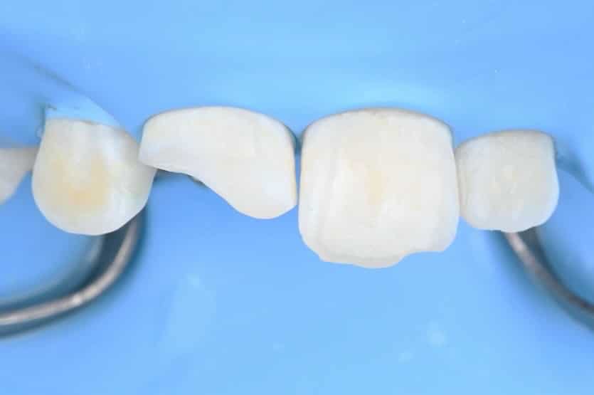 5E0EF45D-C5C1-474D-AA41-09C4FF550BC7