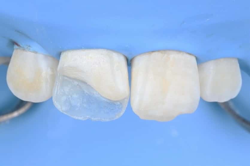 B472C9EC-53A0-4292-AED9-C87C6C7CB1F8