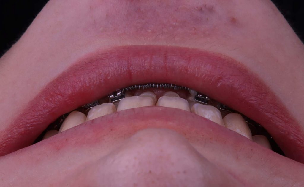 FB_IMG_1709716801980