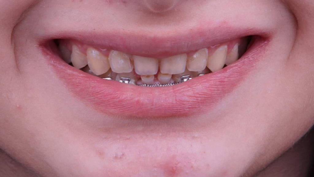 FB_IMG_1709716804279