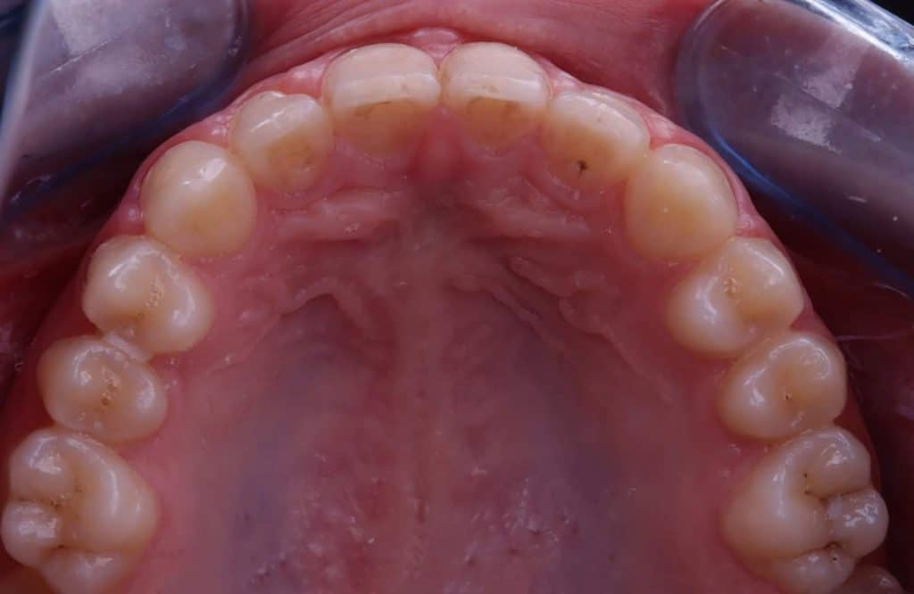 FB_IMG_1709716817107