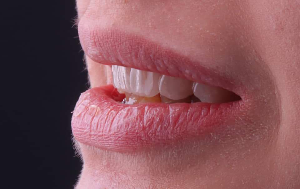 FB_IMG_1709716892448