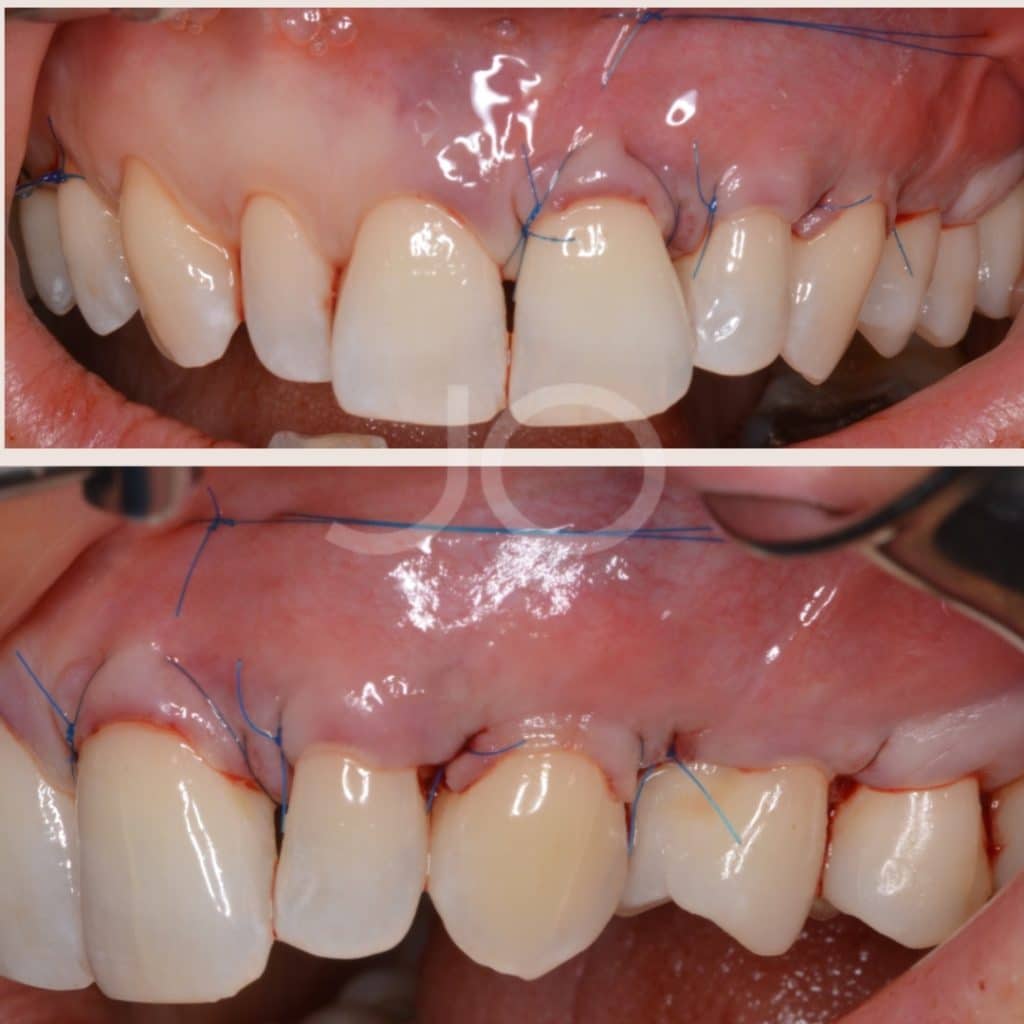 Arantxa Mora Gil (2)