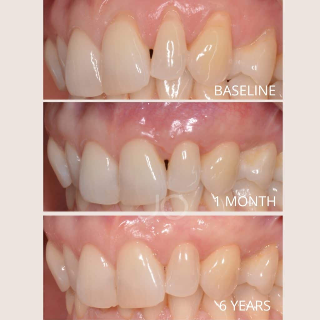 Arantxa Mora Gil (3)