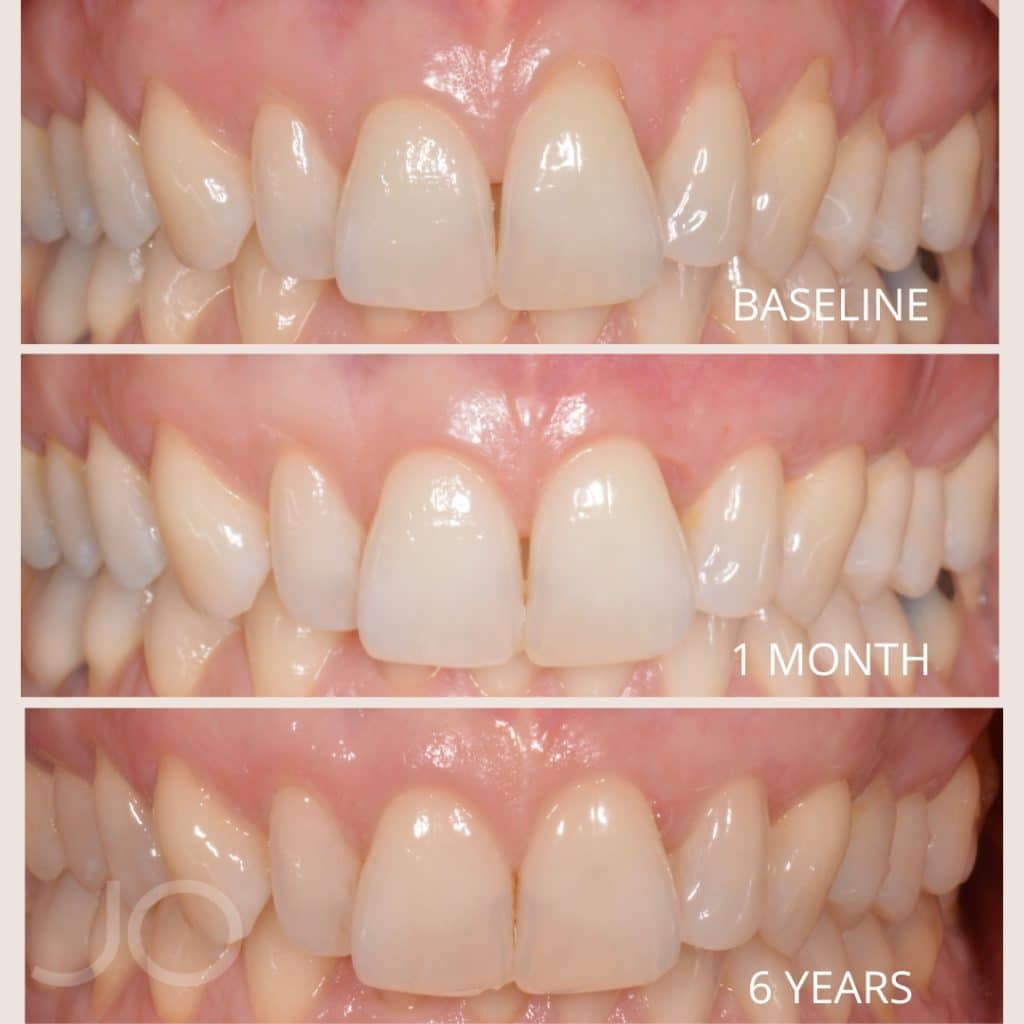 Arantxa Mora Gil (4)