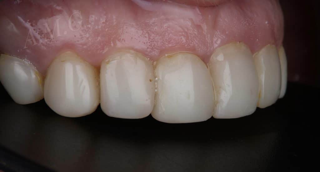 E20DC6D9-F41E-489A-9F7E-D983A2B41D3E