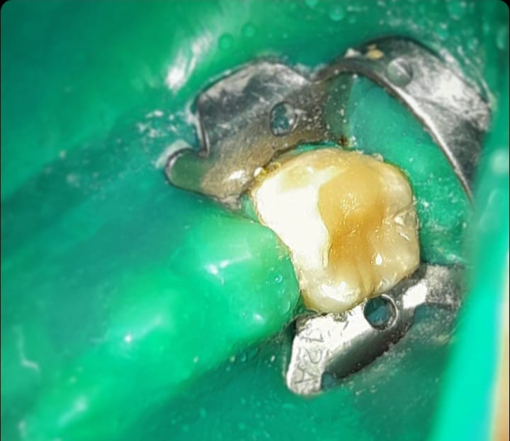 Screenshot_20240401-220841_Instagram