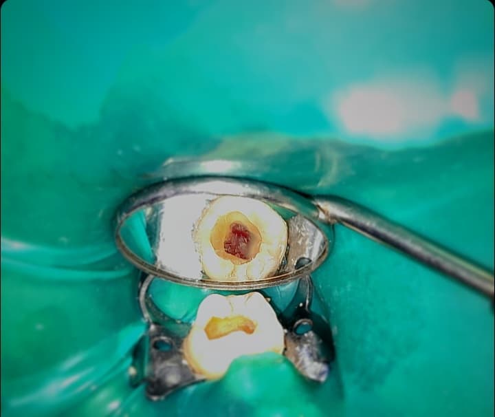 Screenshot_20240401-221011_Instagram