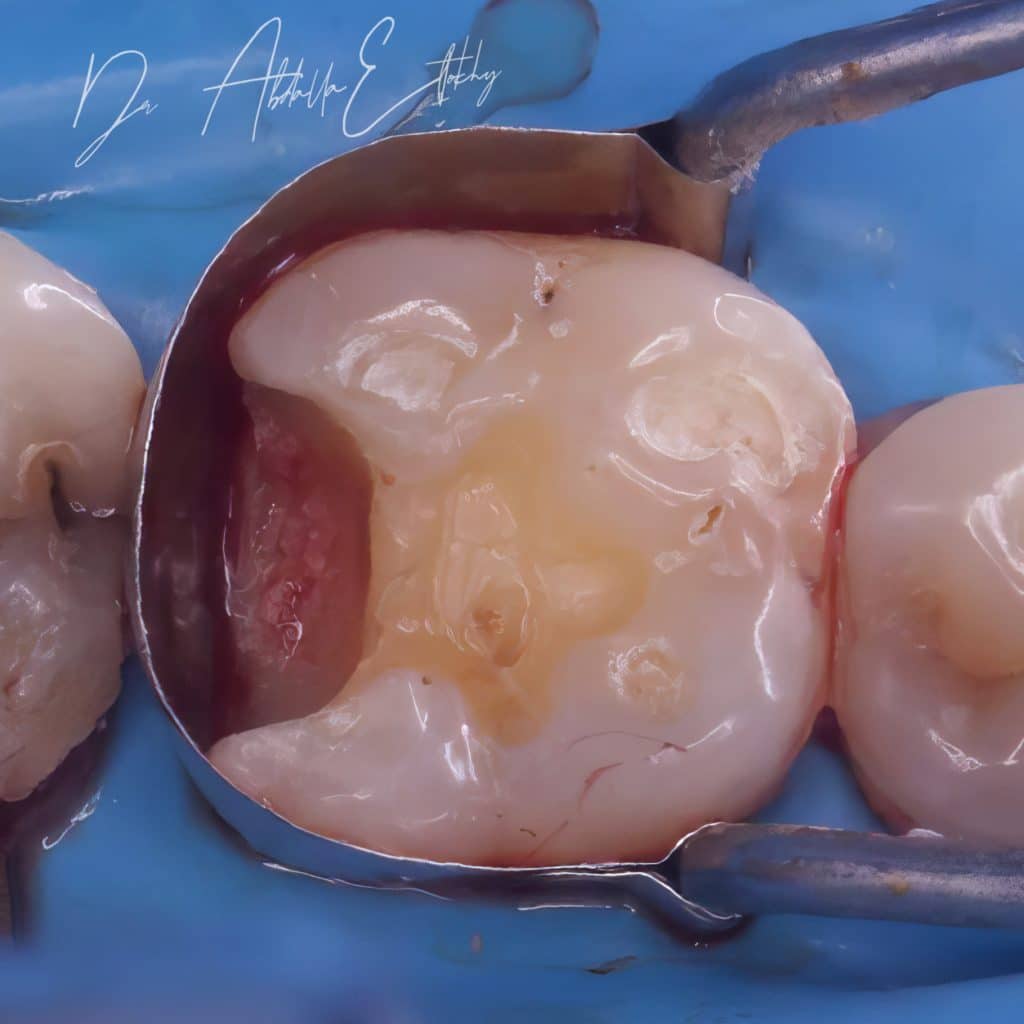 1167730D-2A76-47E5-A137-6B8714ABF064