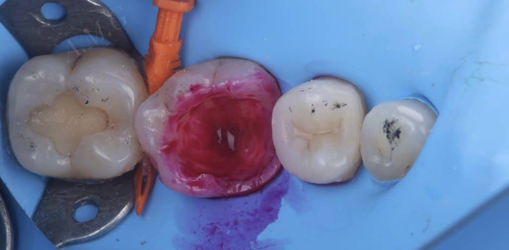 5E50FDEA-6F26-4621-8871-0C301ACE450F