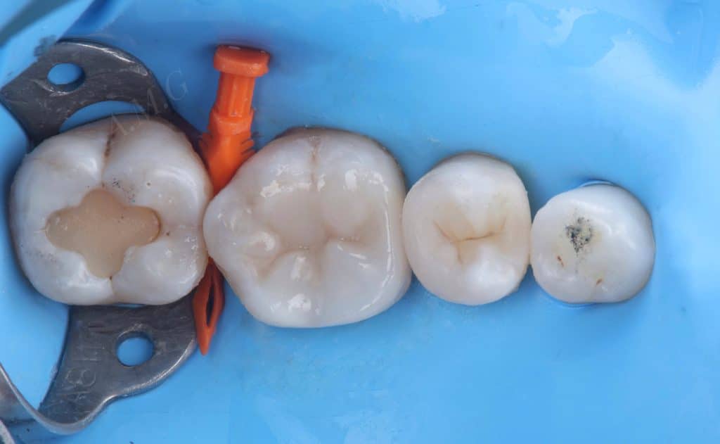 61729455-78AF-42AE-8969-0A206615EB59