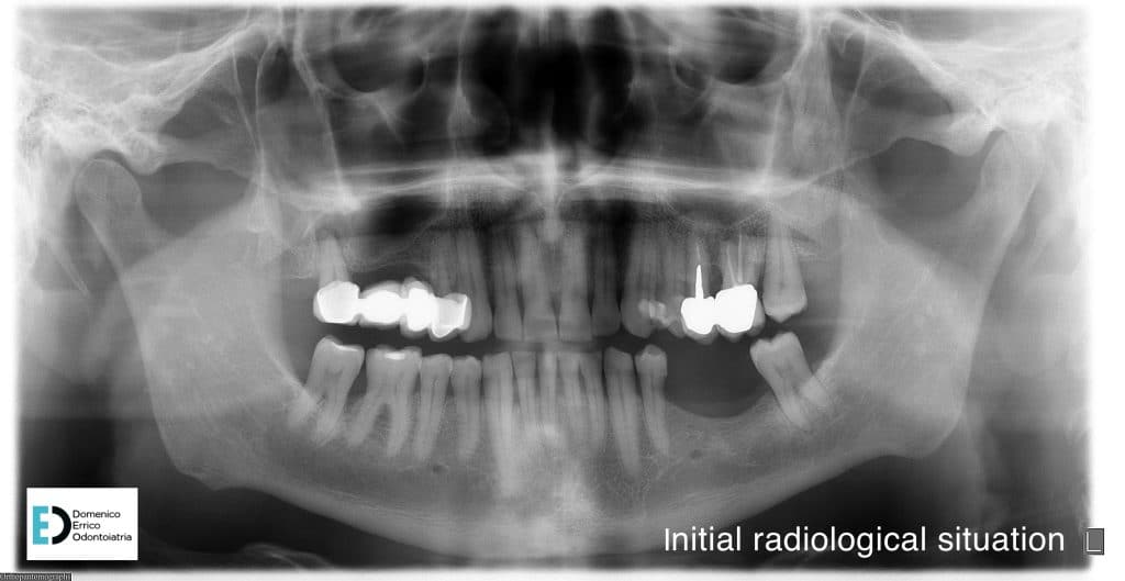 initial radilogical situaton