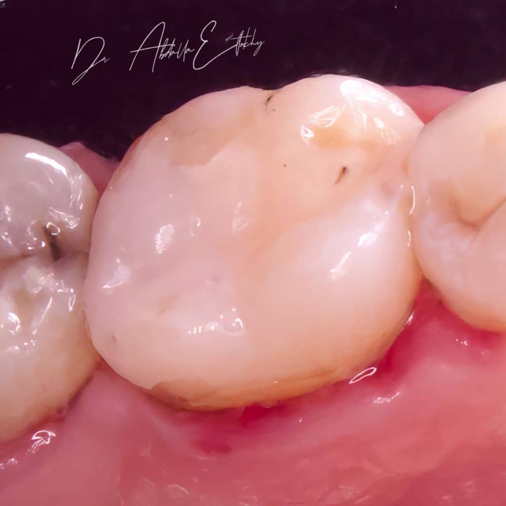 CC1BD2E3-4FC6-4746-B0E4-1F2FEA974775