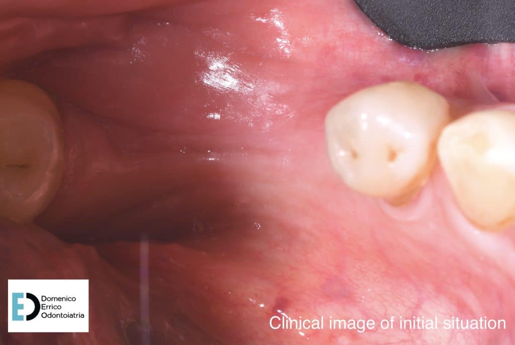 clinical image of initial situation