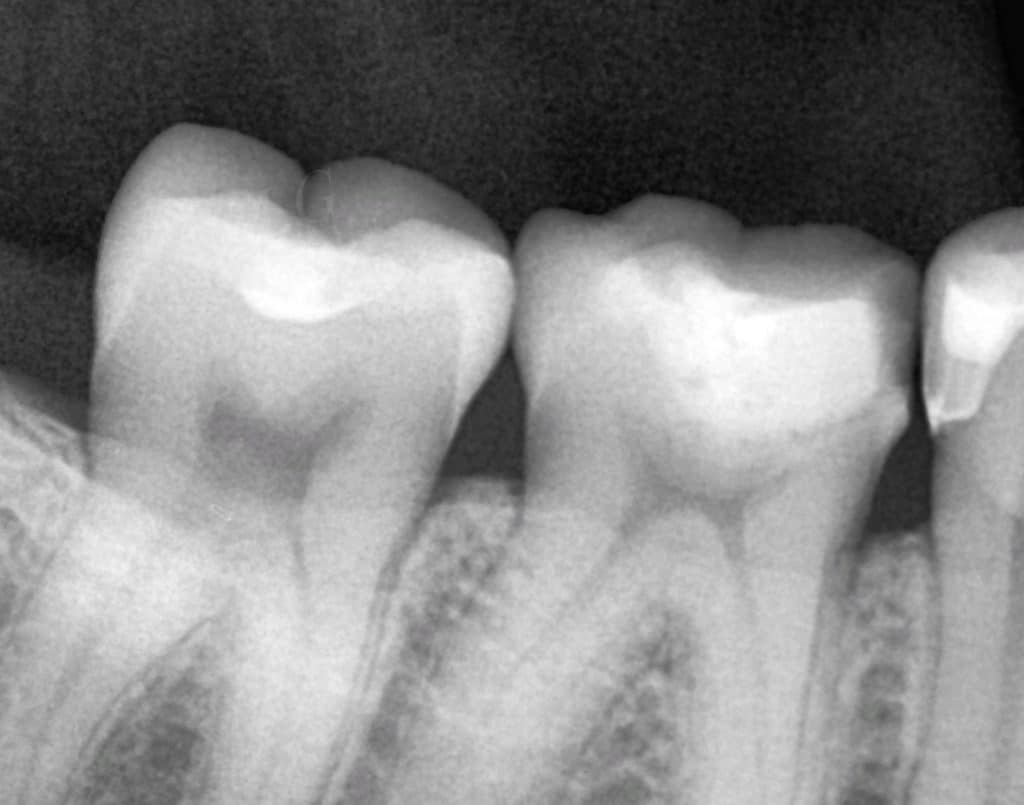 ECAADB4D-26B8-4D8E-BF03-F216E8DDDBF9