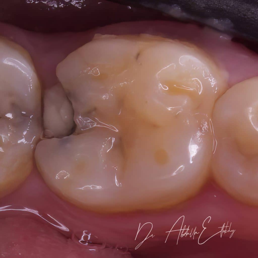 F3777E0C-FE32-43AD-8DF5-E9685C3AA49B