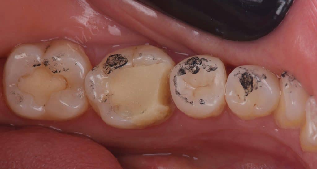 FCBB7C4B-4D53-4A69-8551-2BC22D03D0D1