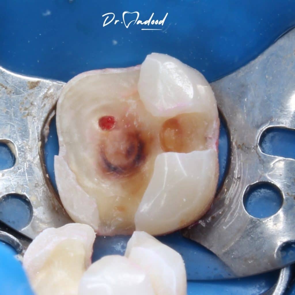 inbound2401295394381159123