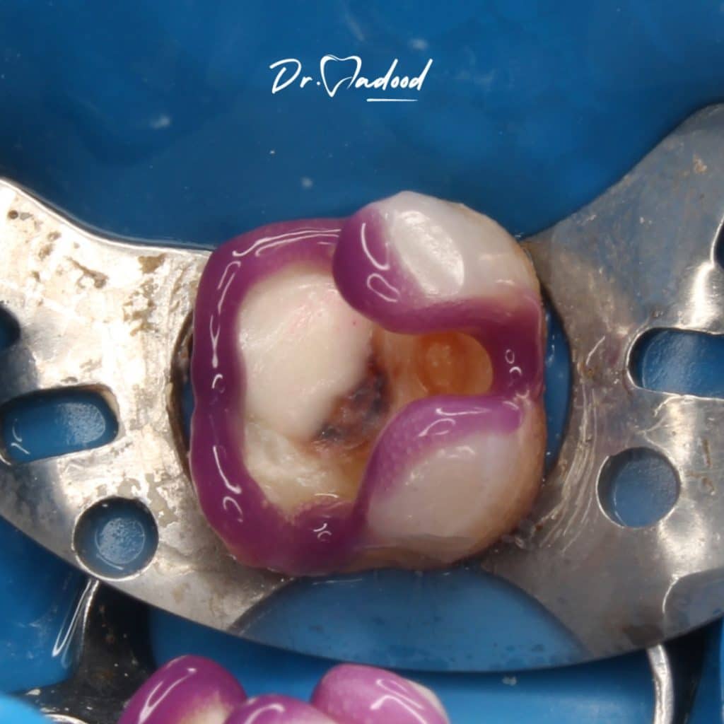 inbound8208152924292832820