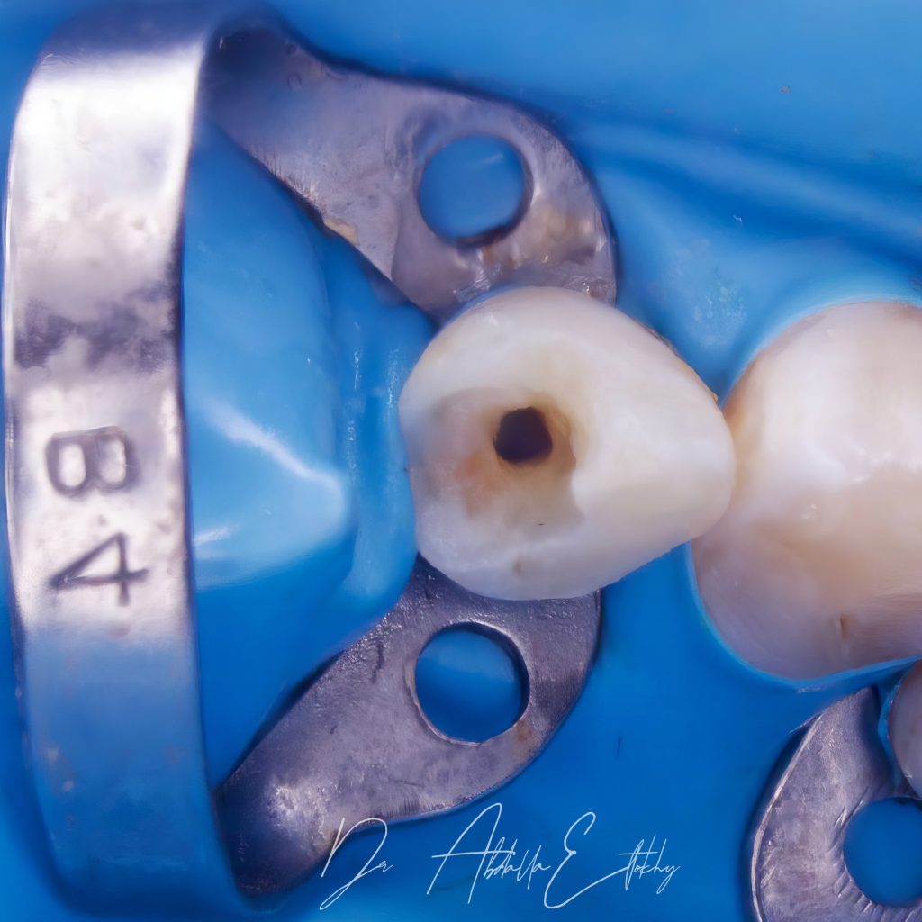 00608FC8-6439-474E-96C1-B5243878FEF9