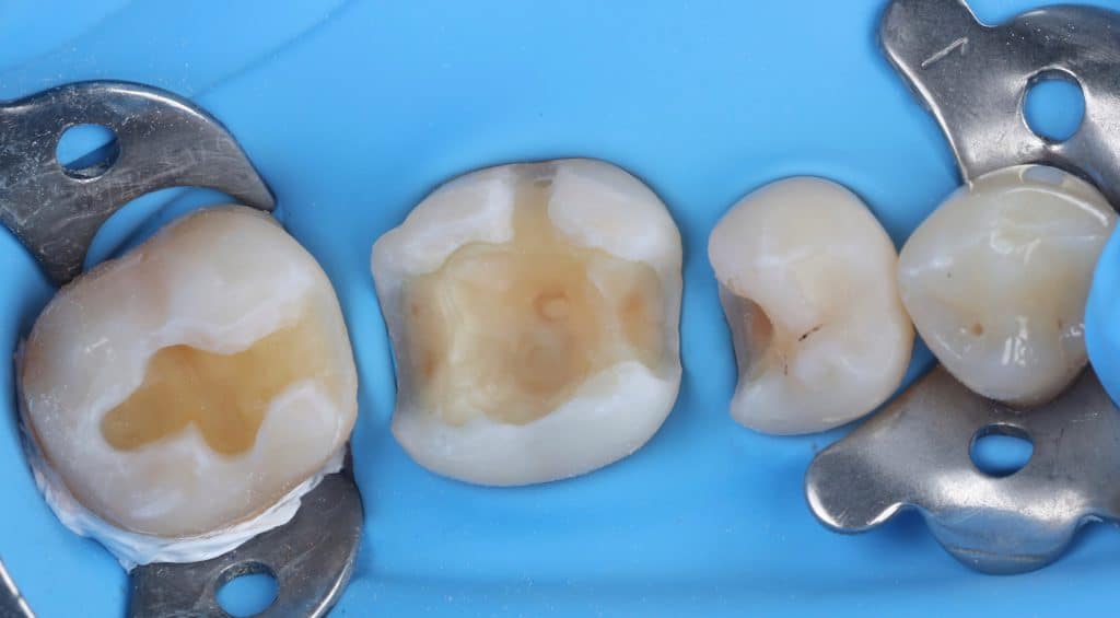 0F7C2590-45E9-4C8A-8D75-0388DA16F04B