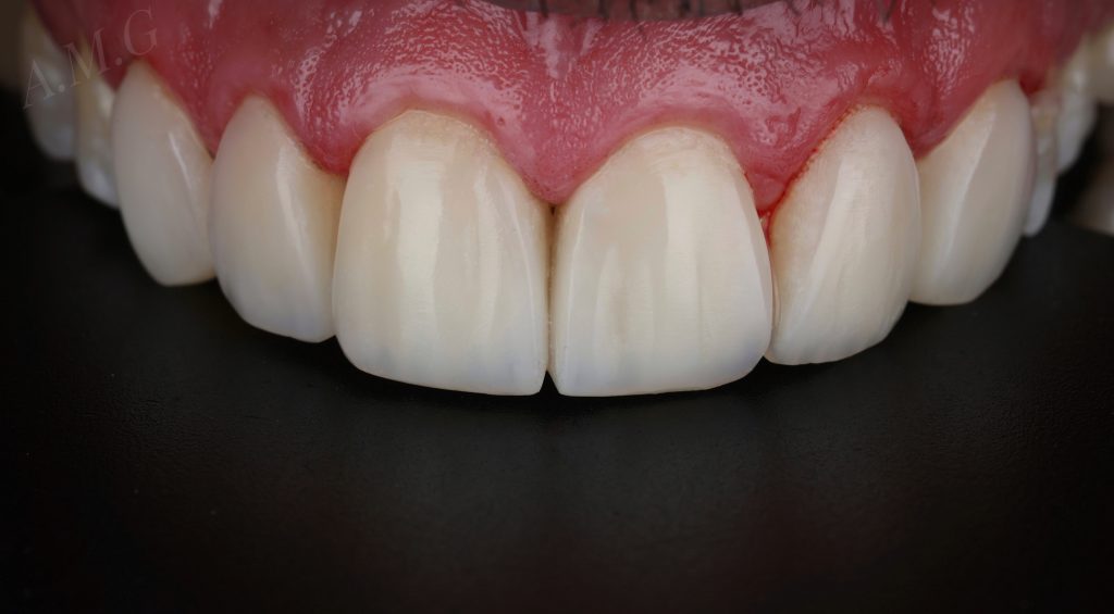 17360A2D-FD3B-4E2E-9D82-523E5526F532