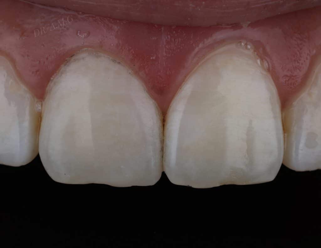 18D69323-7A1C-437F-B52B-380D3574C9B2