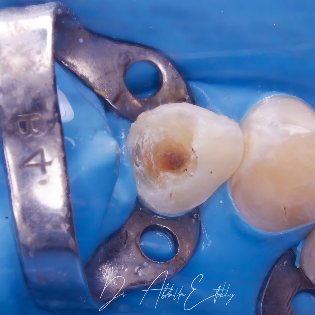 1F5306DE-DBBB-460C-A384-6FF952B7DBF3