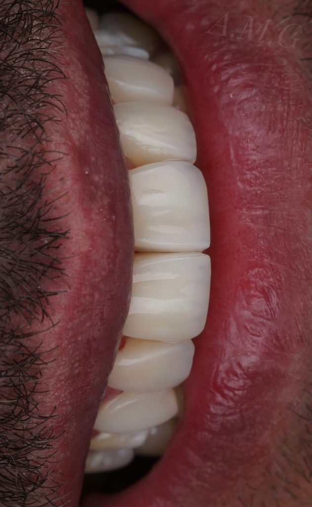 39DE9085-F6DB-4D0C-A2B8-9487BB041776