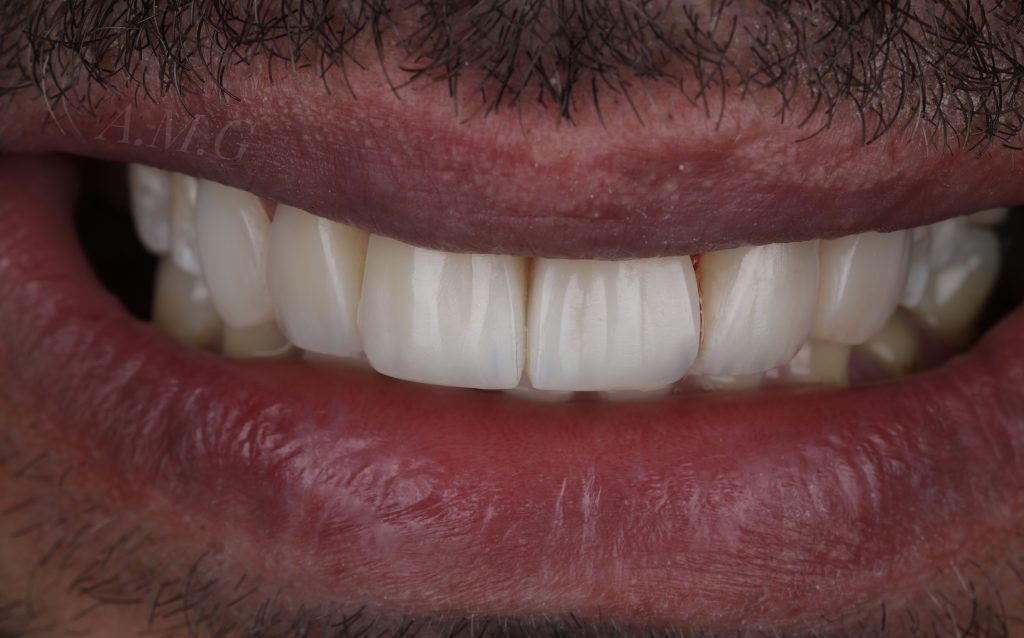 55C92D84-A5F4-4153-A5A8-729F74B6DCFA