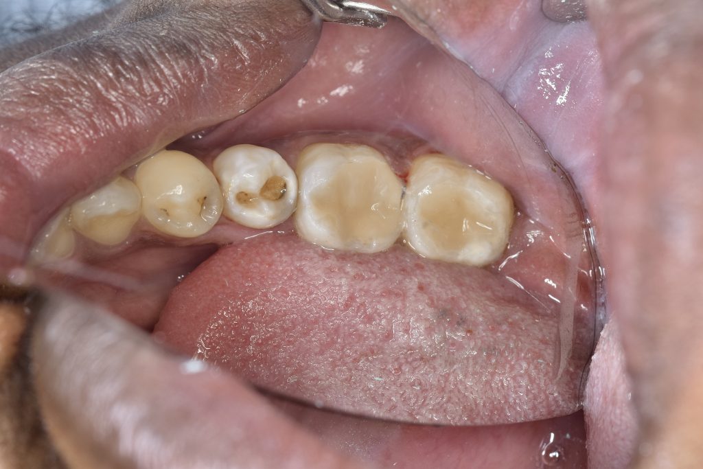 5A9E2364-2D08-4BDE-A5A5-51B867B26BB6