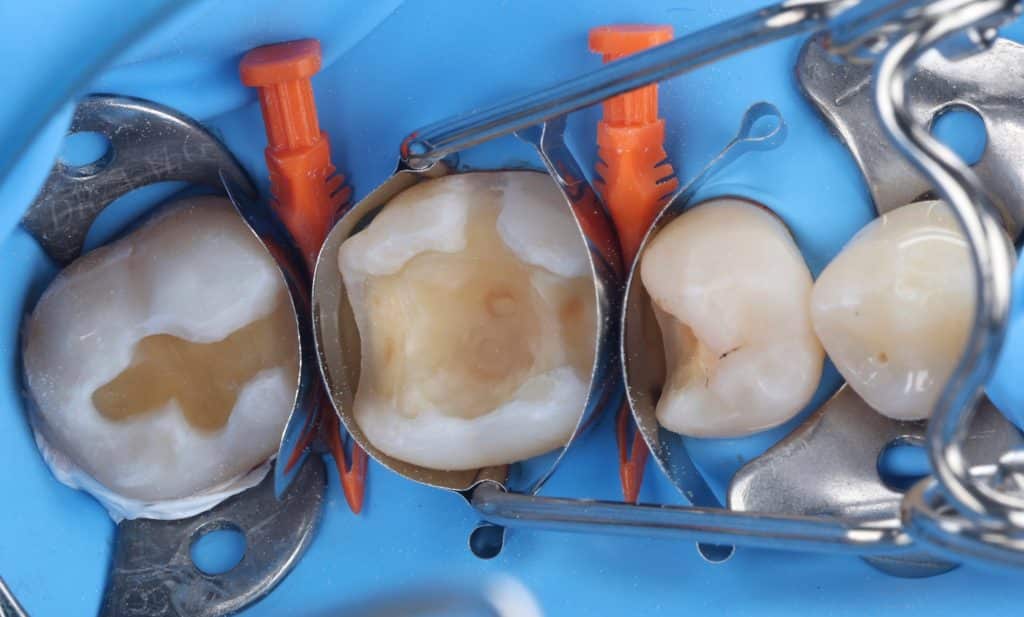 877D7E7E-2D45-45EE-9392-F5FA27B44B84