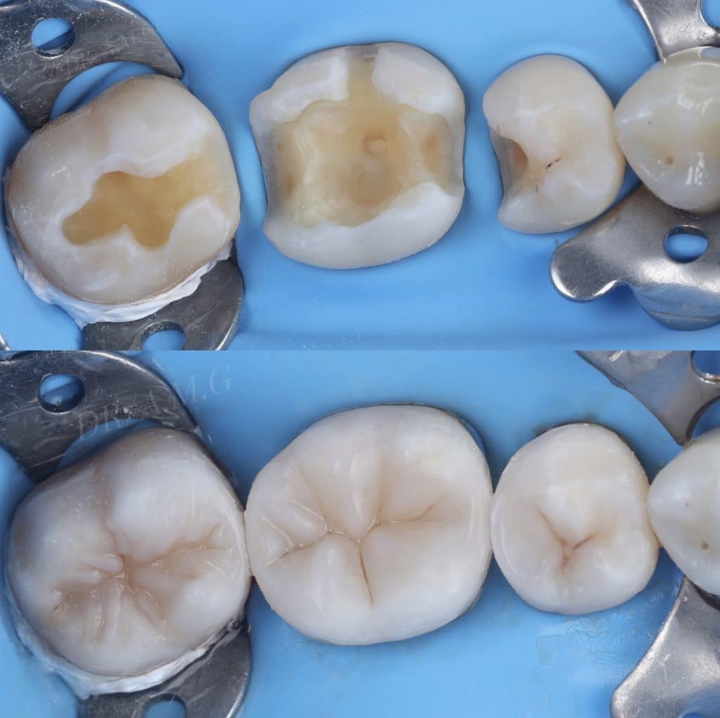 887AABE5-4D33-447E-A151-7A6A0E2BB648