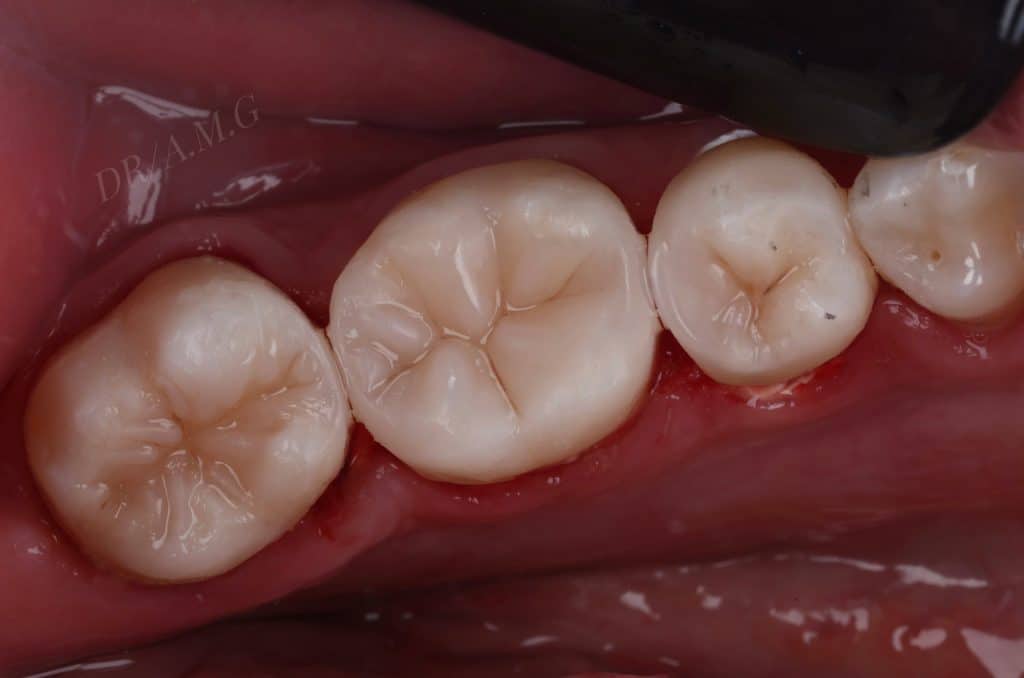 ACA96F27-AEA7-4F98-A80D-CF57F165EE06