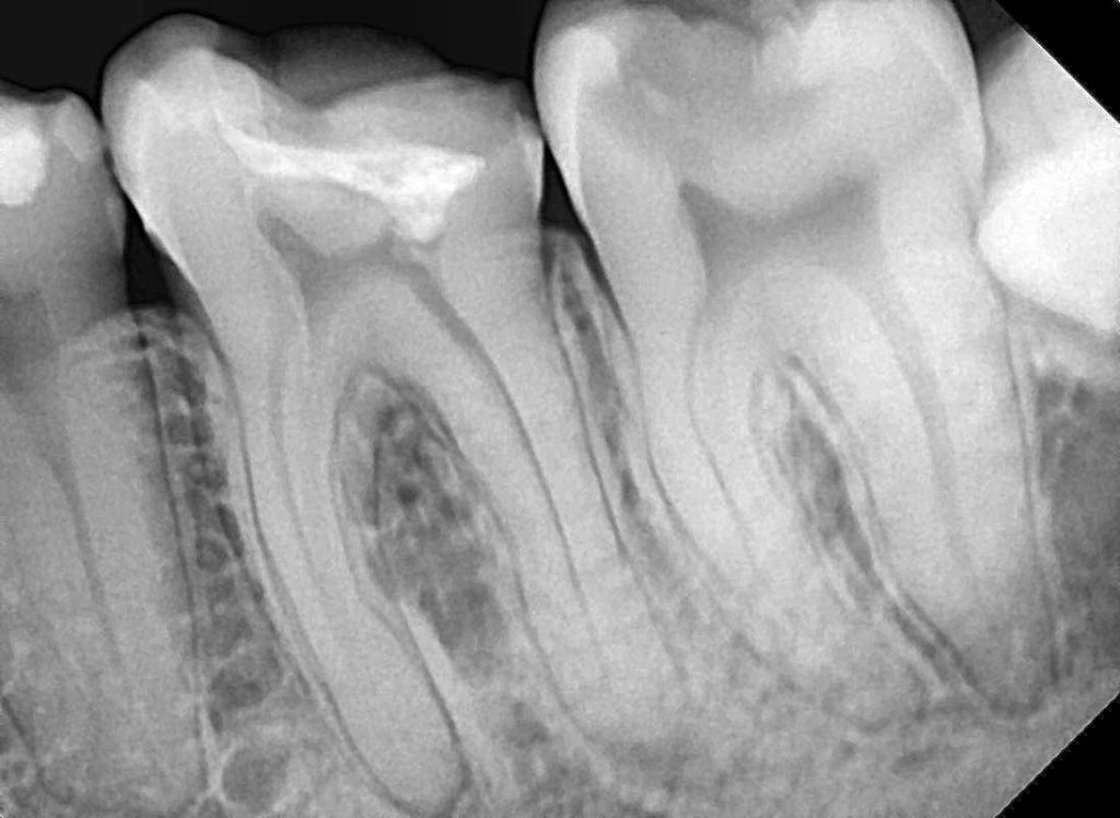 E005C67D-8DA5-4FA6-AEEA-85E74AAE6E31