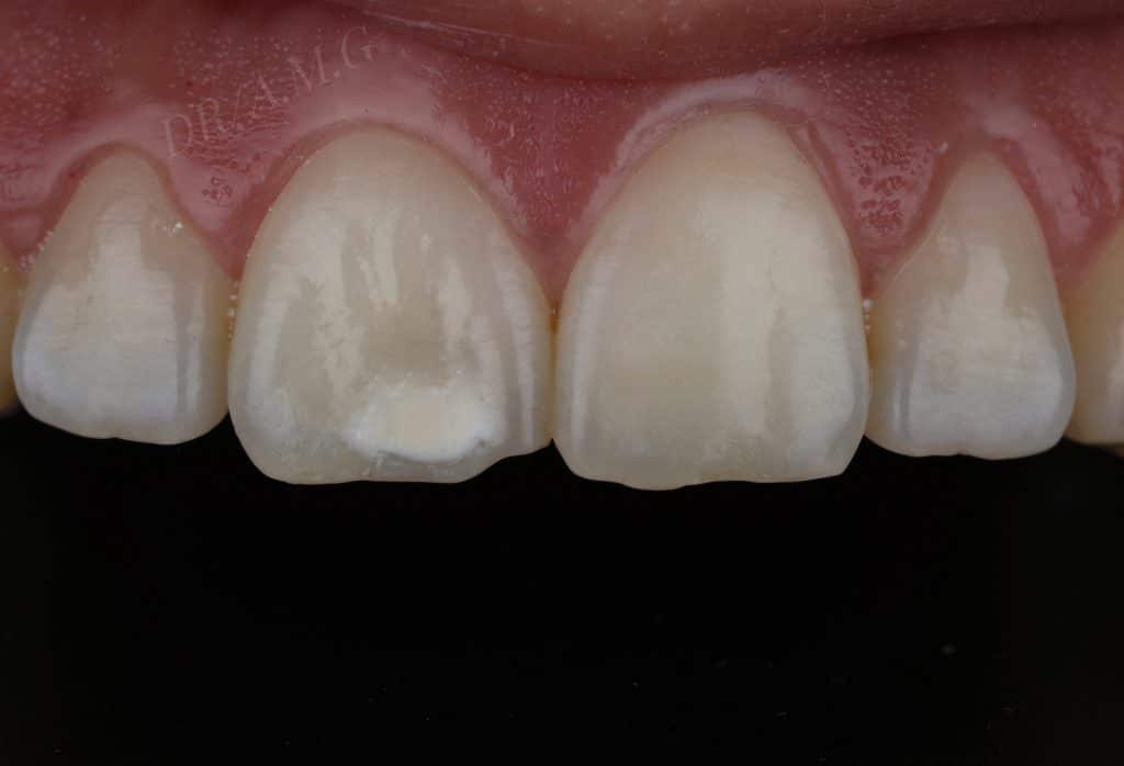 E2D863FF-843D-4DB6-8722-011D8B2B1B4C